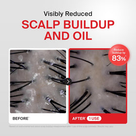 DR.FORHAIR detailed salt granules highlighting mineral-rich exfoliation benefit