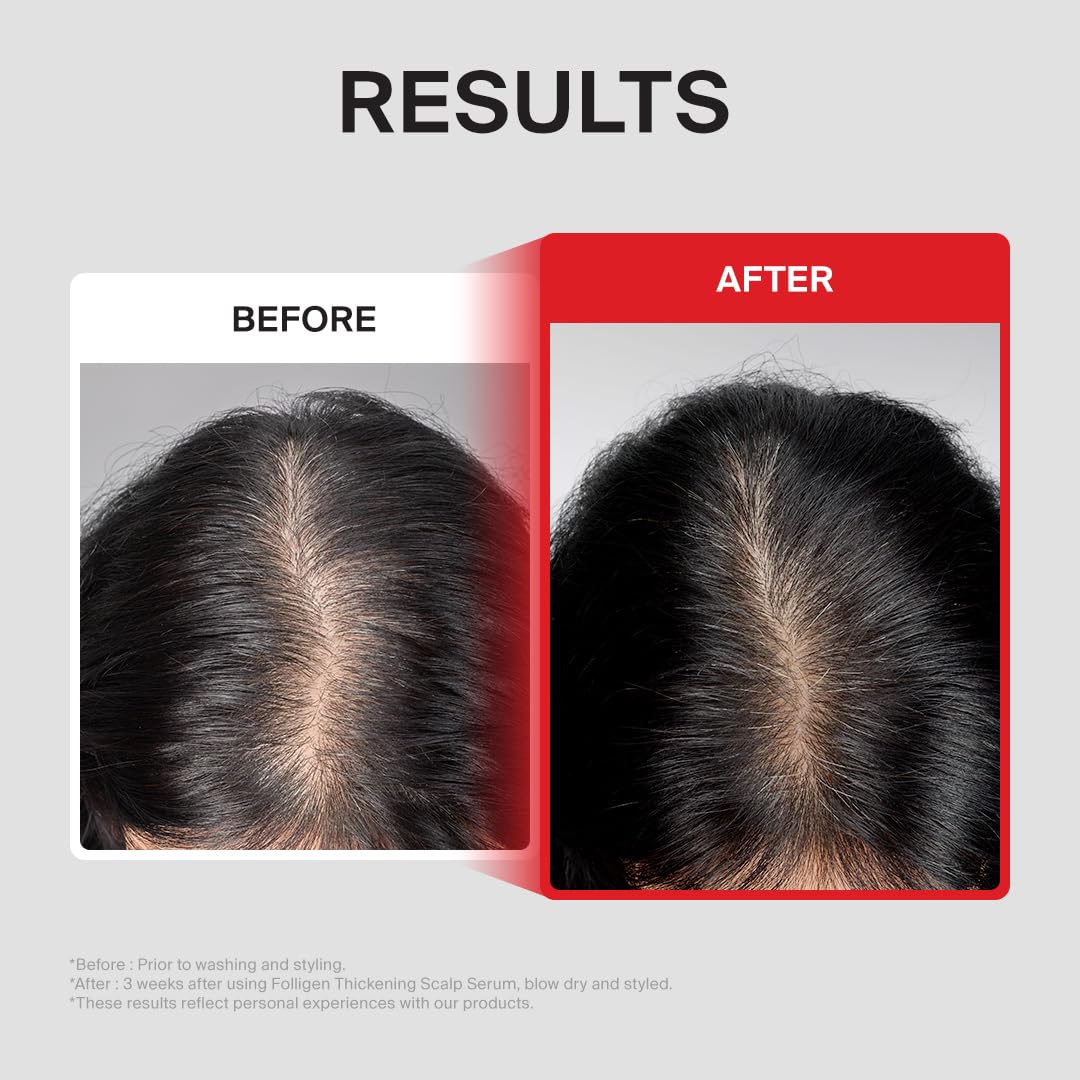 Dr.FORHAIR applied to scalp by hand showing targeted application benefit