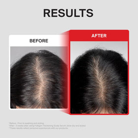 Dr.FORHAIR applied to scalp by hand showing targeted application benefit