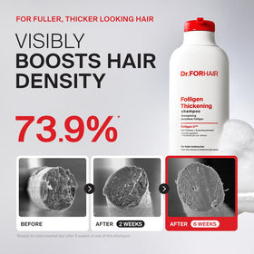 Dr.FORHAIR product texture on palm showcasing lightweight formula benefit