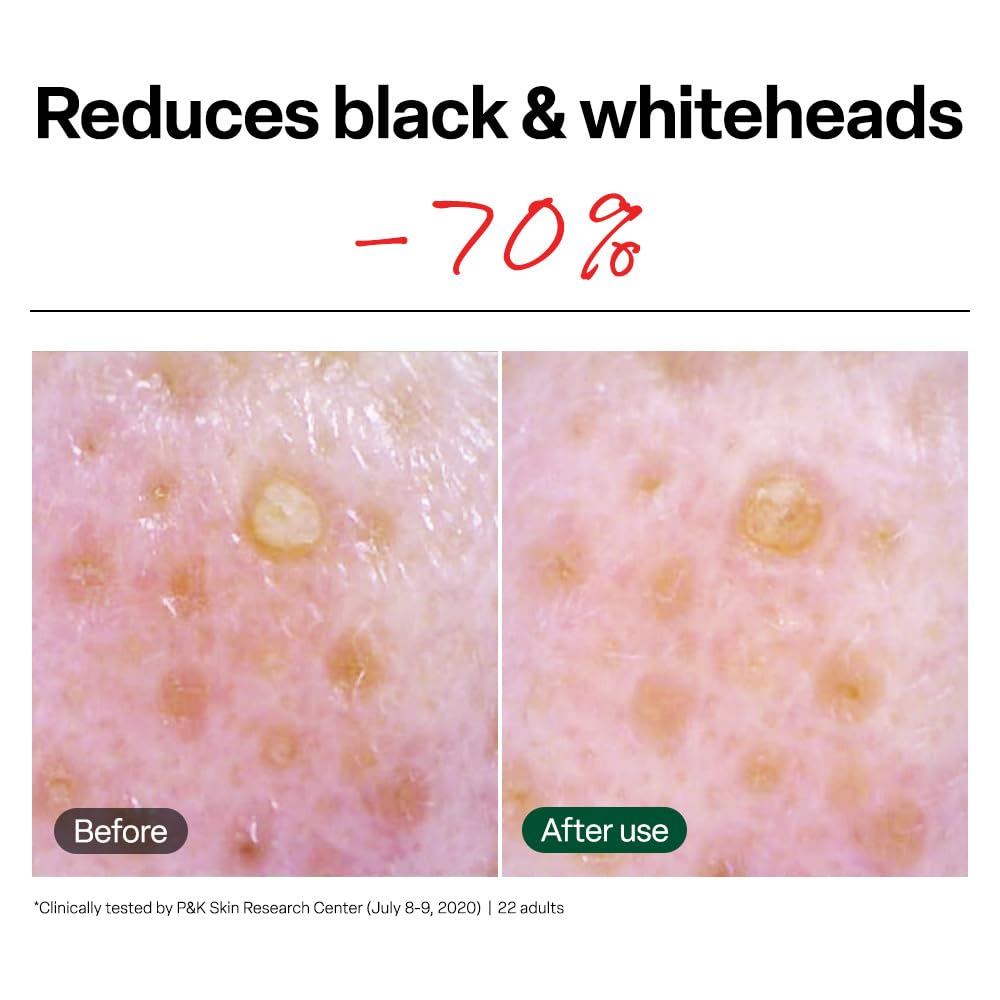 Dr.G pad saturated with serum highlighting hydrating exfoliant action