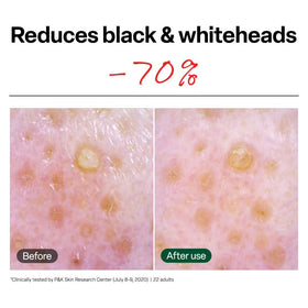 Dr.G pad saturated with serum highlighting hydrating exfoliant action