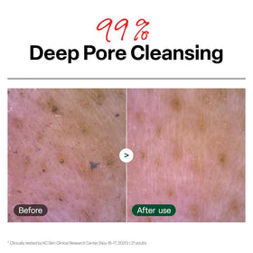 Dr.G closeup of gel texture highlighting hydrating, non‑stripping finish
