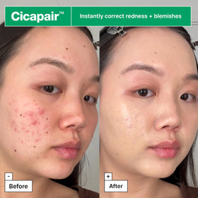 Dr.Jart+ before and after application on cheek showing reduced redness