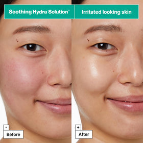Dr.Jart+ essence on fingers illustrating concentrated hydrating formula