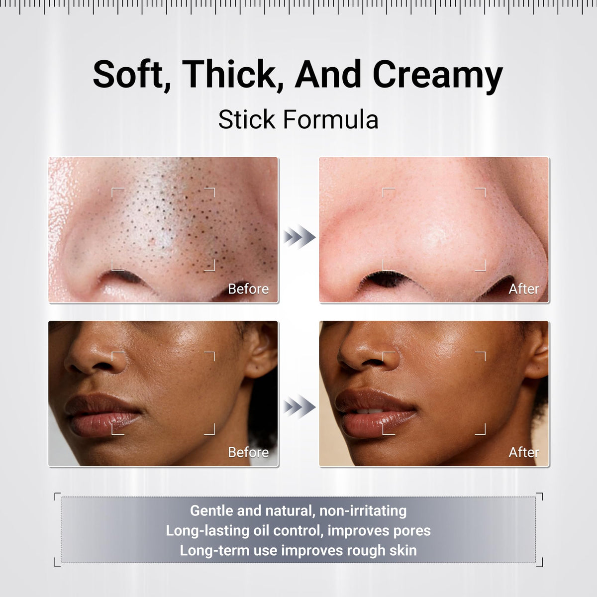 Dr.Leo application on nose showing targeted blackhead removal action