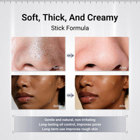 Dr.Leo application on nose showing targeted blackhead removal action