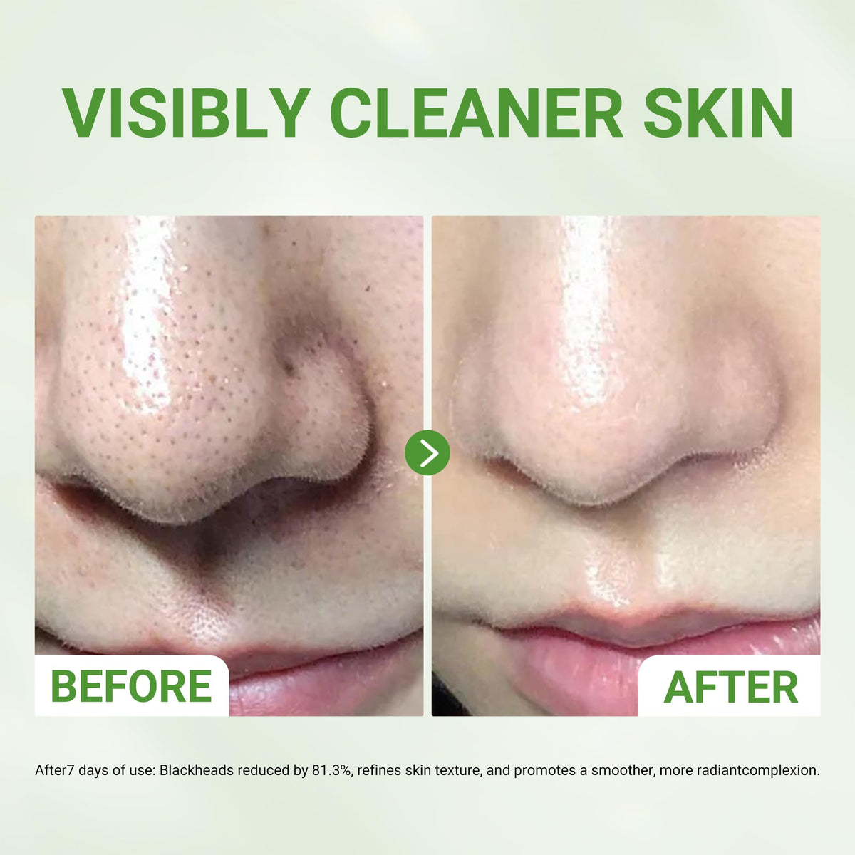 Dr.Leo mask applied on cheek demonstrating easy spread and coverage