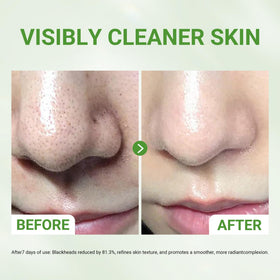 Dr.Leo mask applied on cheek demonstrating easy spread and coverage