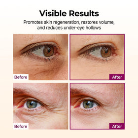 Dr.Melaxin application under eye demonstration, targets fine lines