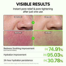Dr.Melaxin mist in use cooling skin and reducing puffiness
