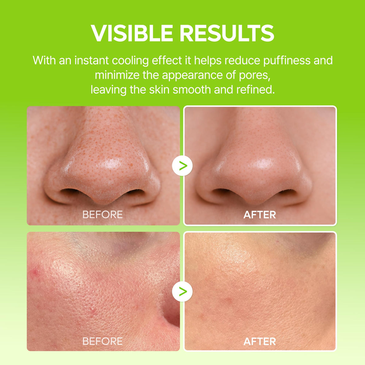Dr.Melaxin t-zone spot treatment in use minimizing pore appearance benefit