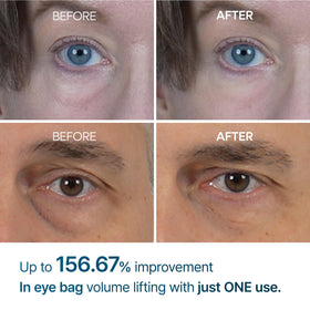 Dr.Melaxin bio-spicule graphic highlighting enhanced ingredient delivery benefit