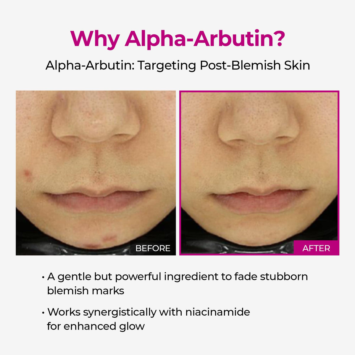 Dr.Melaxin label showing alpha‑arbutin and niacinamide ingredient highlights