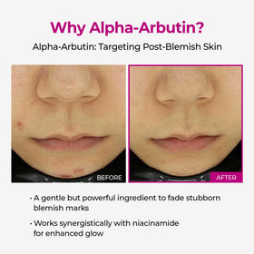 Dr.Melaxin label showing alpha‑arbutin and niacinamide ingredient highlights