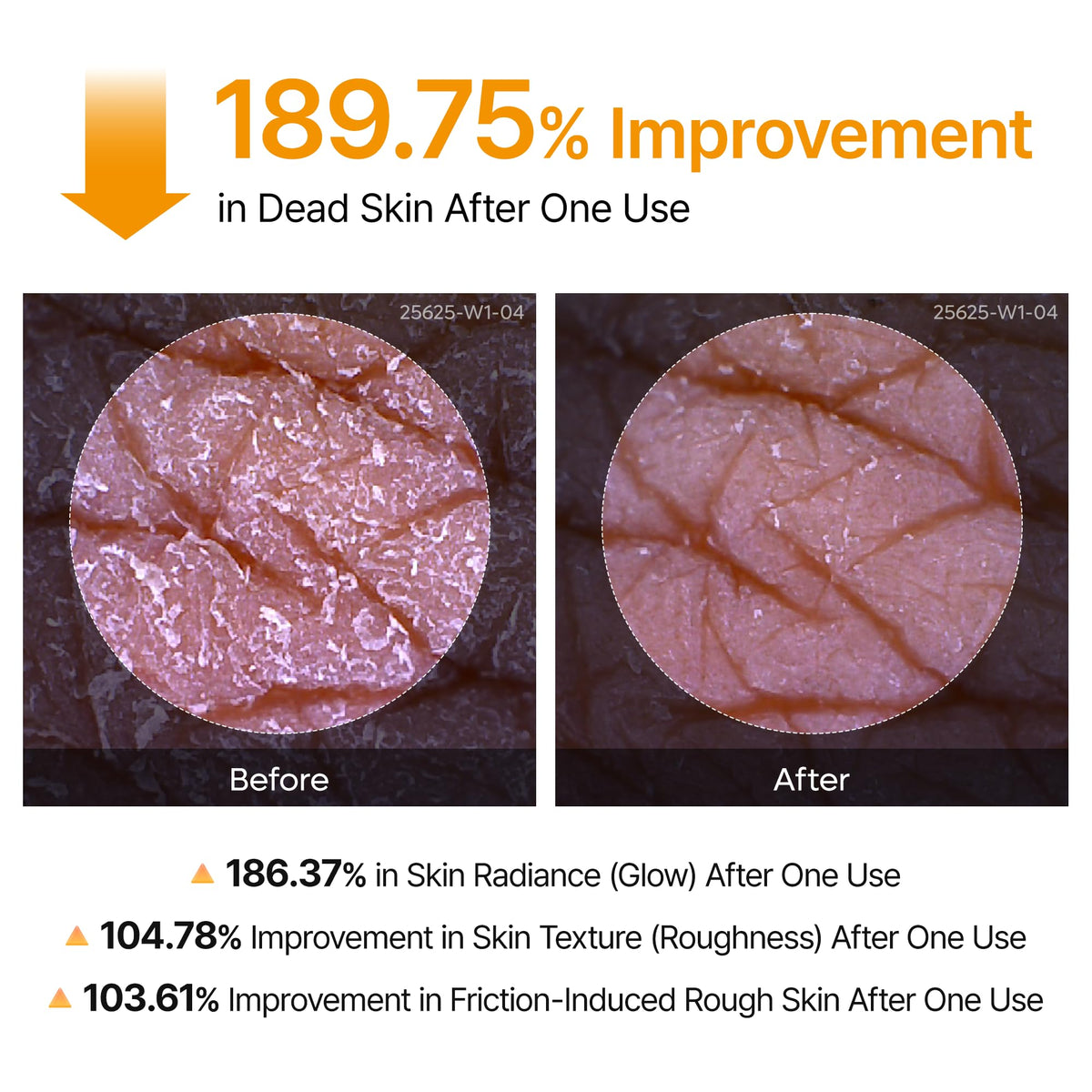 Dr.Melaxin spray on arm demonstrating application for smoother skin