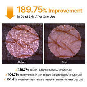 Dr.Melaxin spray on arm demonstrating application for smoother skin