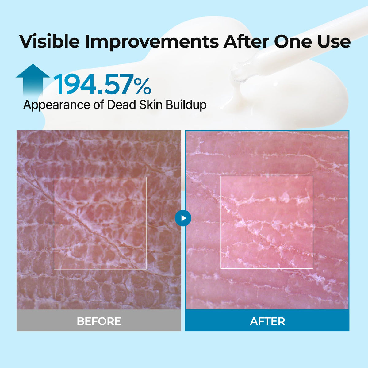 Dr.Melaxin close-up of lightweight serum texture for gentle exfoliation