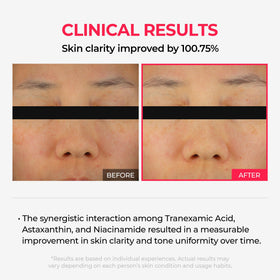 Dr.Melaxin mask texture close-up highlighting smooth creamy consistency