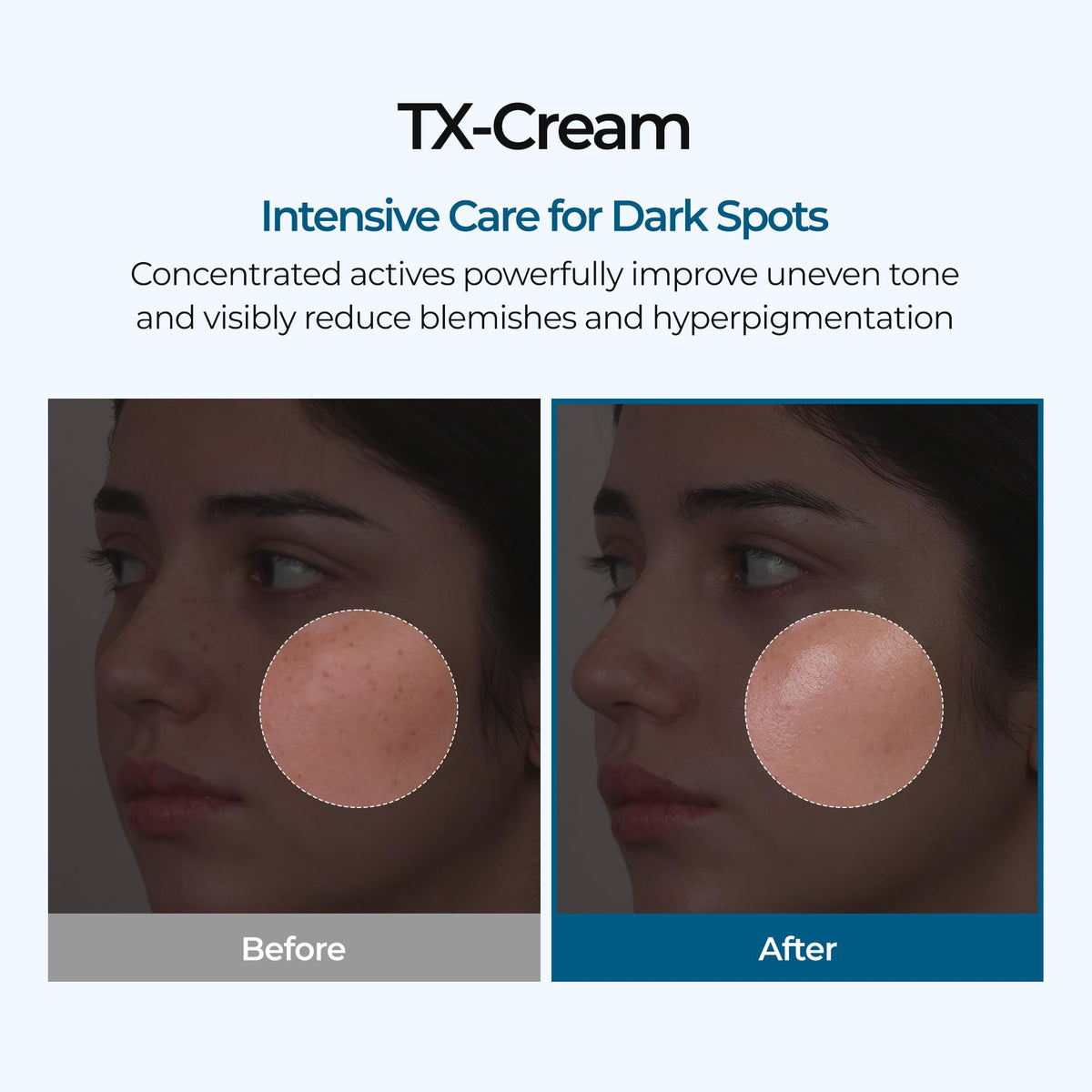 Dr.Melaxin tube cap detail highlighting easy dispensing benefit