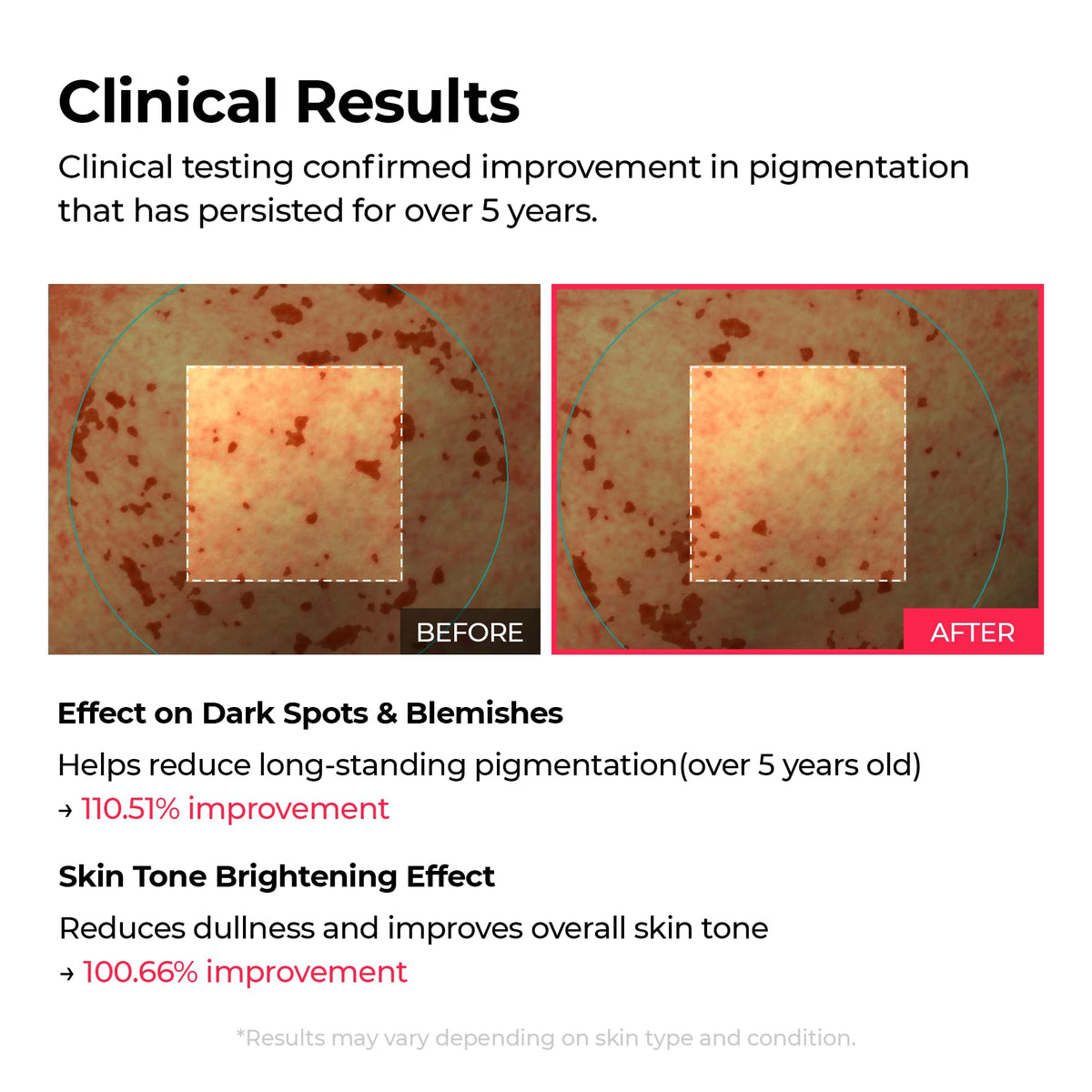 Dr.Melaxin jelly texture close-up demonstrating lightweight hydration