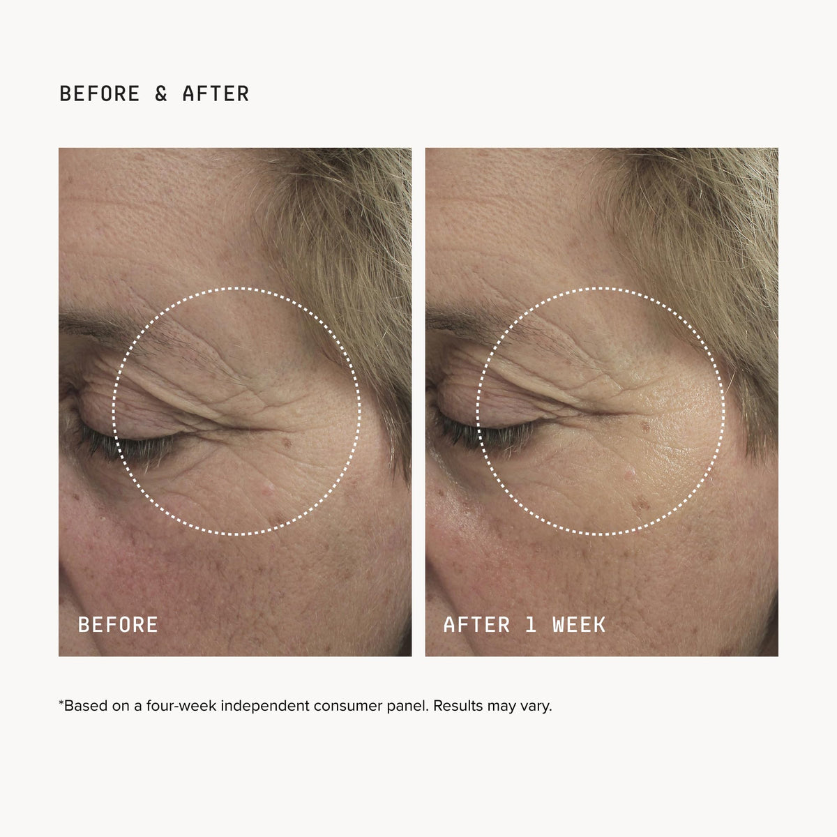 DRMTLGY mask in hand for size and scale to show precise under-eye coverage