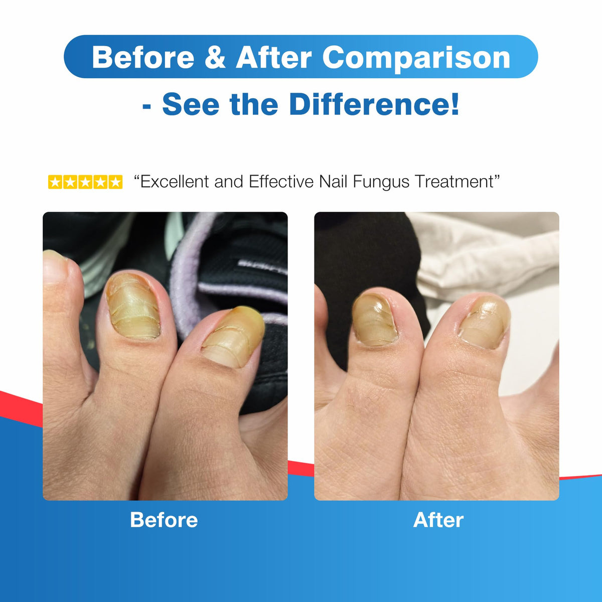 DR.RAPID pen being applied to fingernail for targeted care