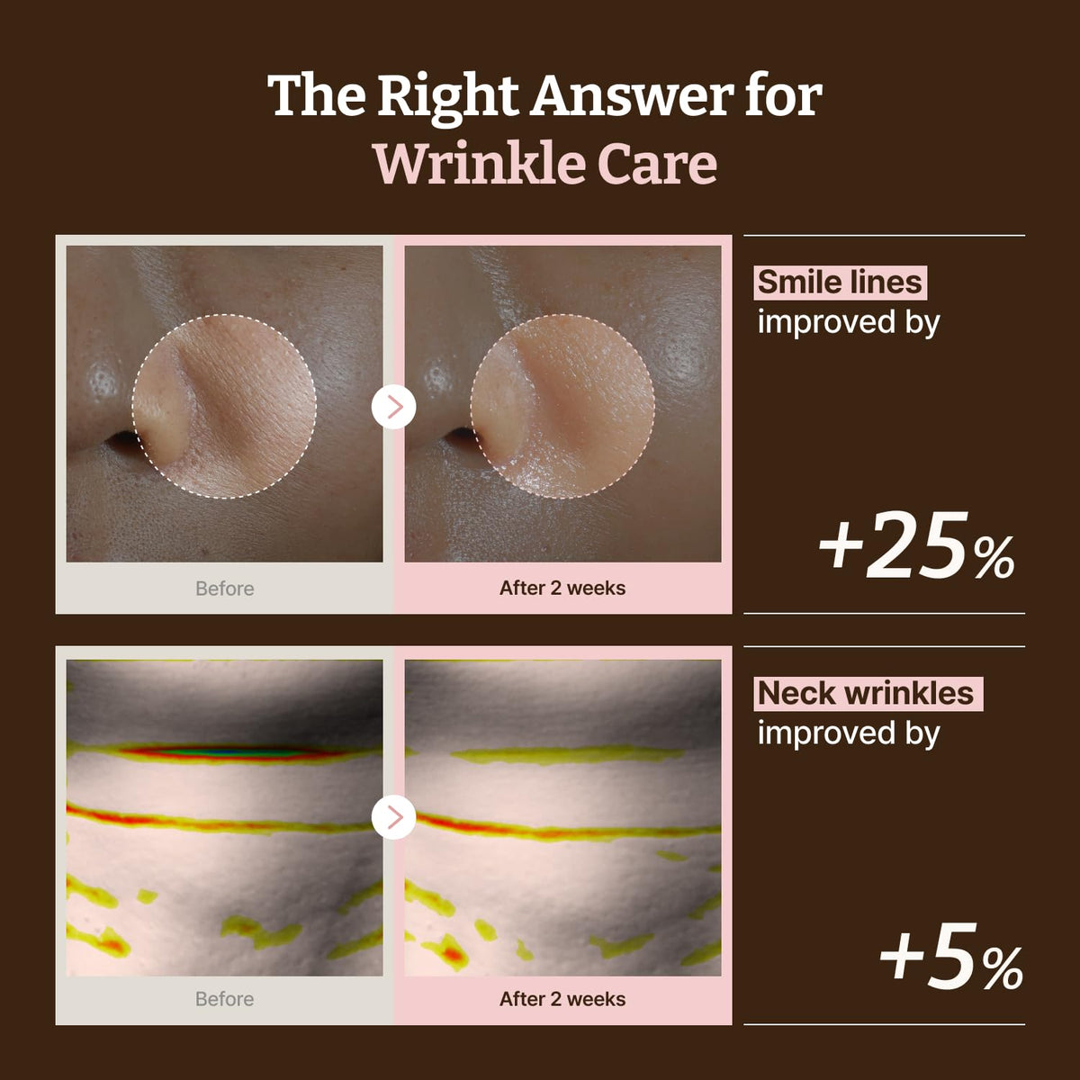 Dr.Reju-All face mask in use providing hydration and soothing