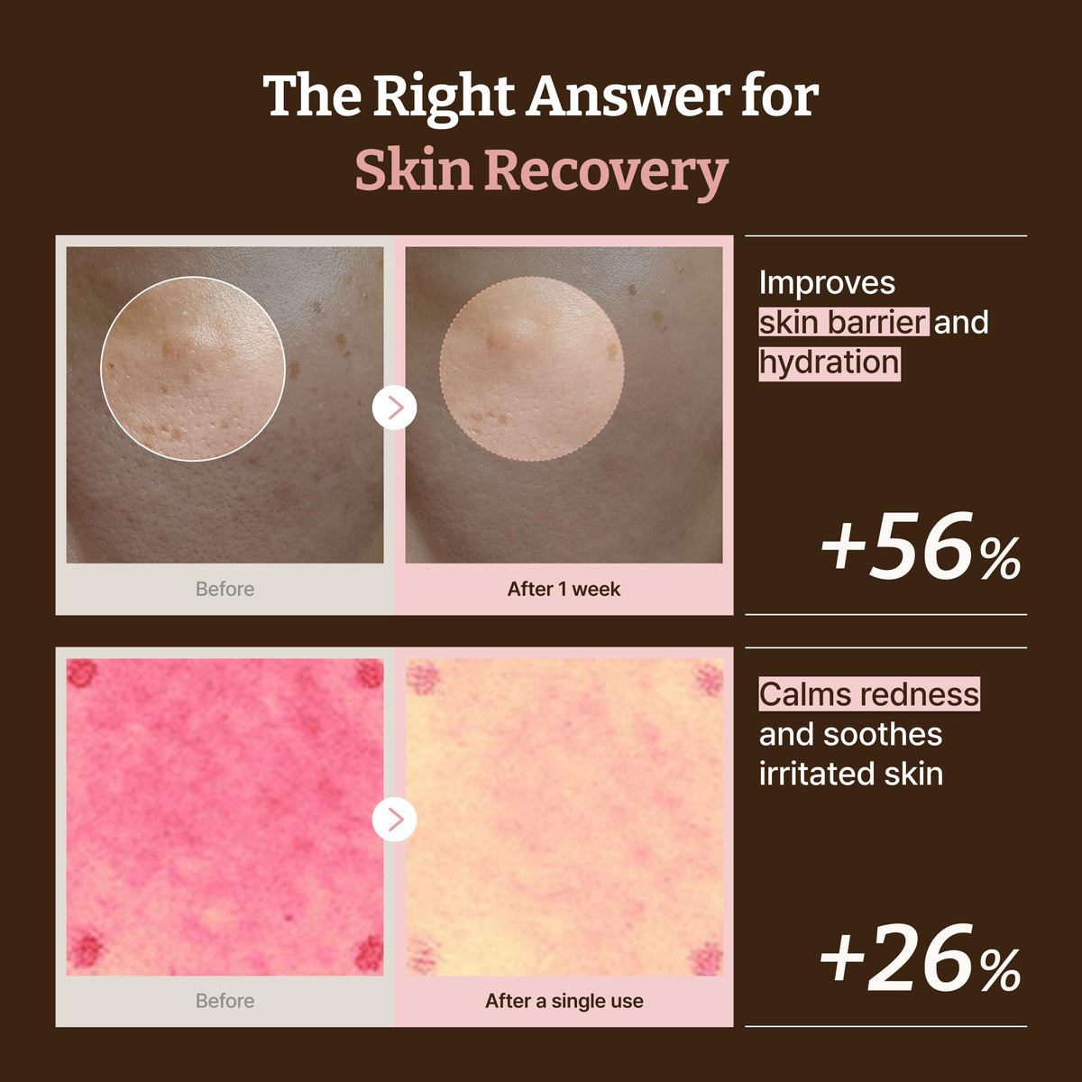 Dr.Reju-All ingredient label focused on PDRN and actives, clarifies purity and formulation benefits