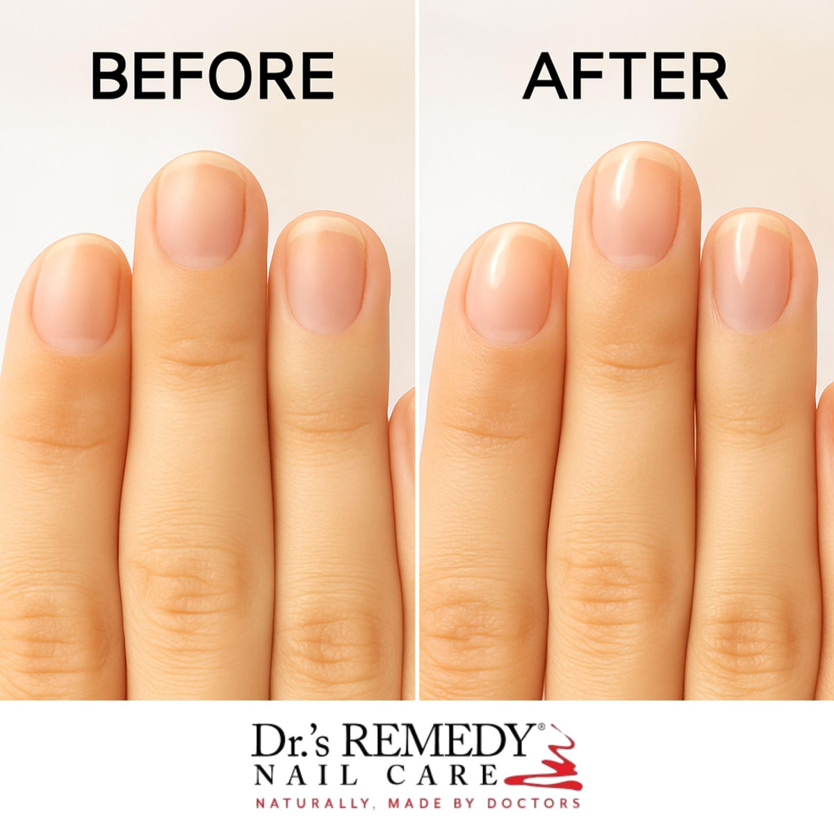 Dr.'s Remedy clear polish drop highlighting glossy texture and quick dry benefit