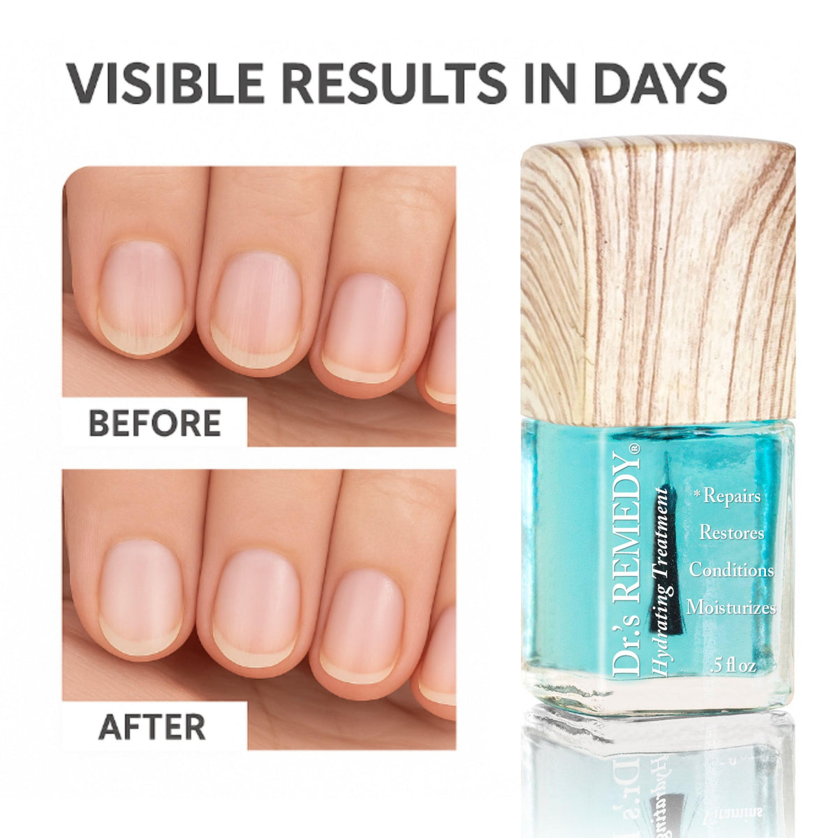 Dr.'s Remedy TOTAL two-in-one polish open to show color-free protective formula benefits