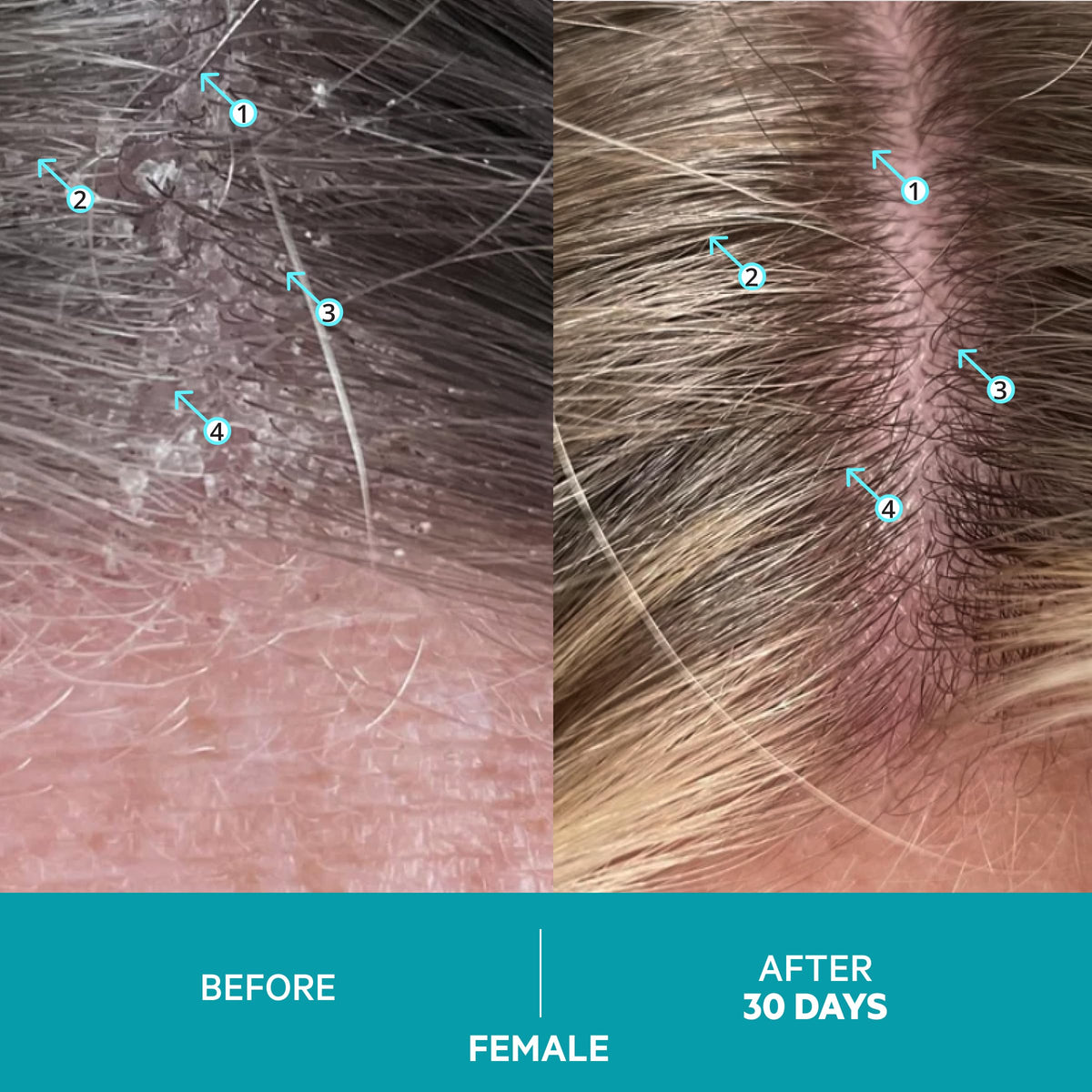 DS Laboratories being massaged into scalp delivering exfoliation