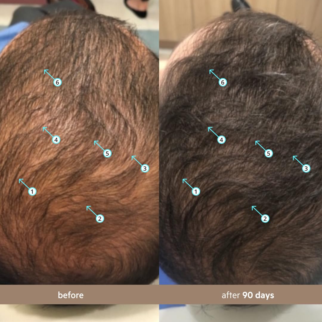 DS Laboratories Spectral Men’s demonstrated scalp application showing quick, mess-free use
