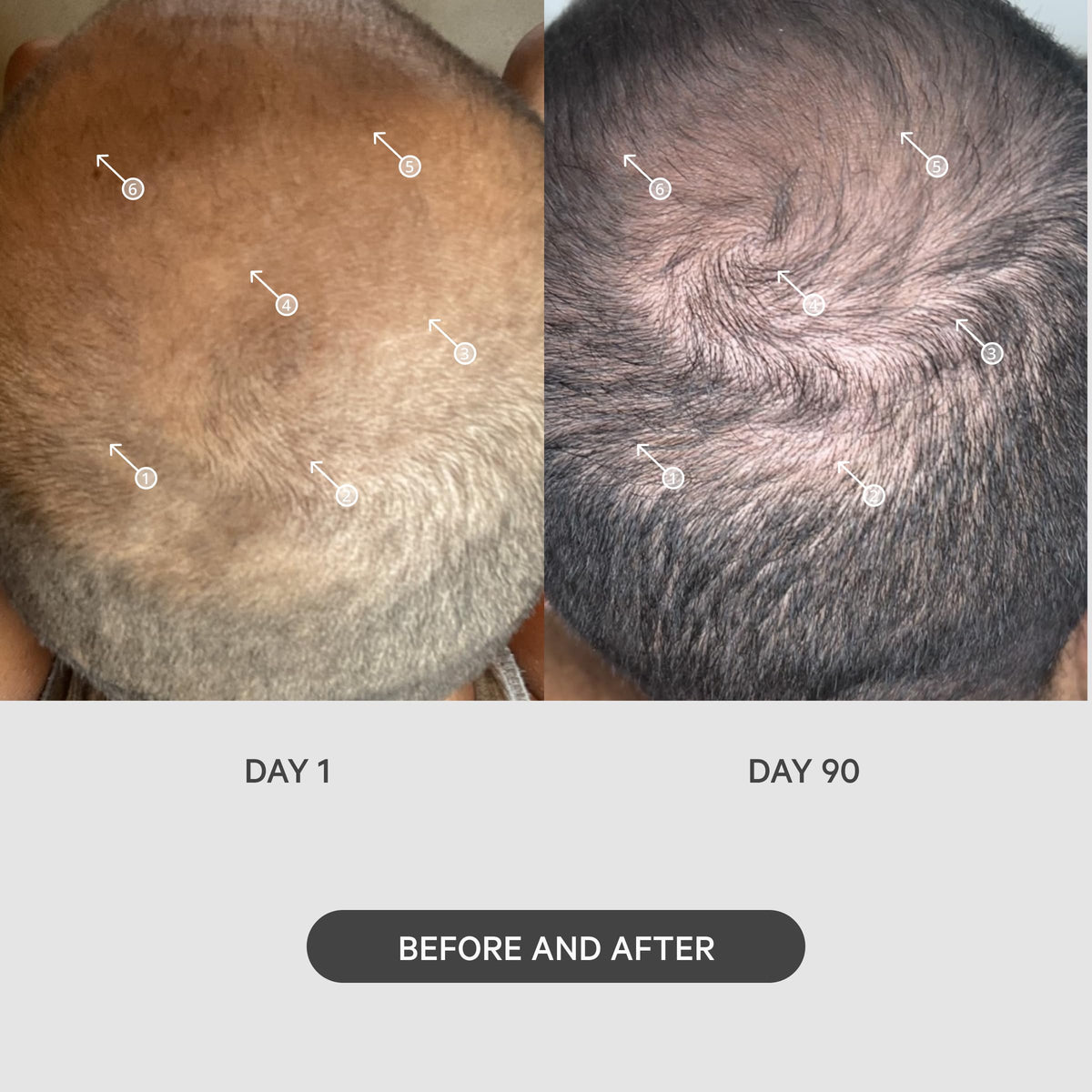 DS Laboratories StimuROLLER in-hand rolling on scalp for improved topical application