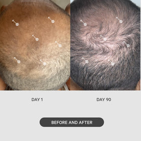 DS Laboratories StimuROLLER in-hand rolling on scalp for improved topical application