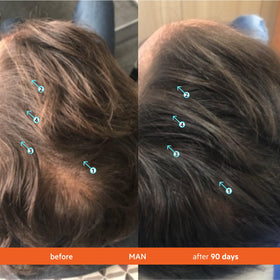 DS Laboratories before-and-after hair photos showing fuller-looking, smoother strands