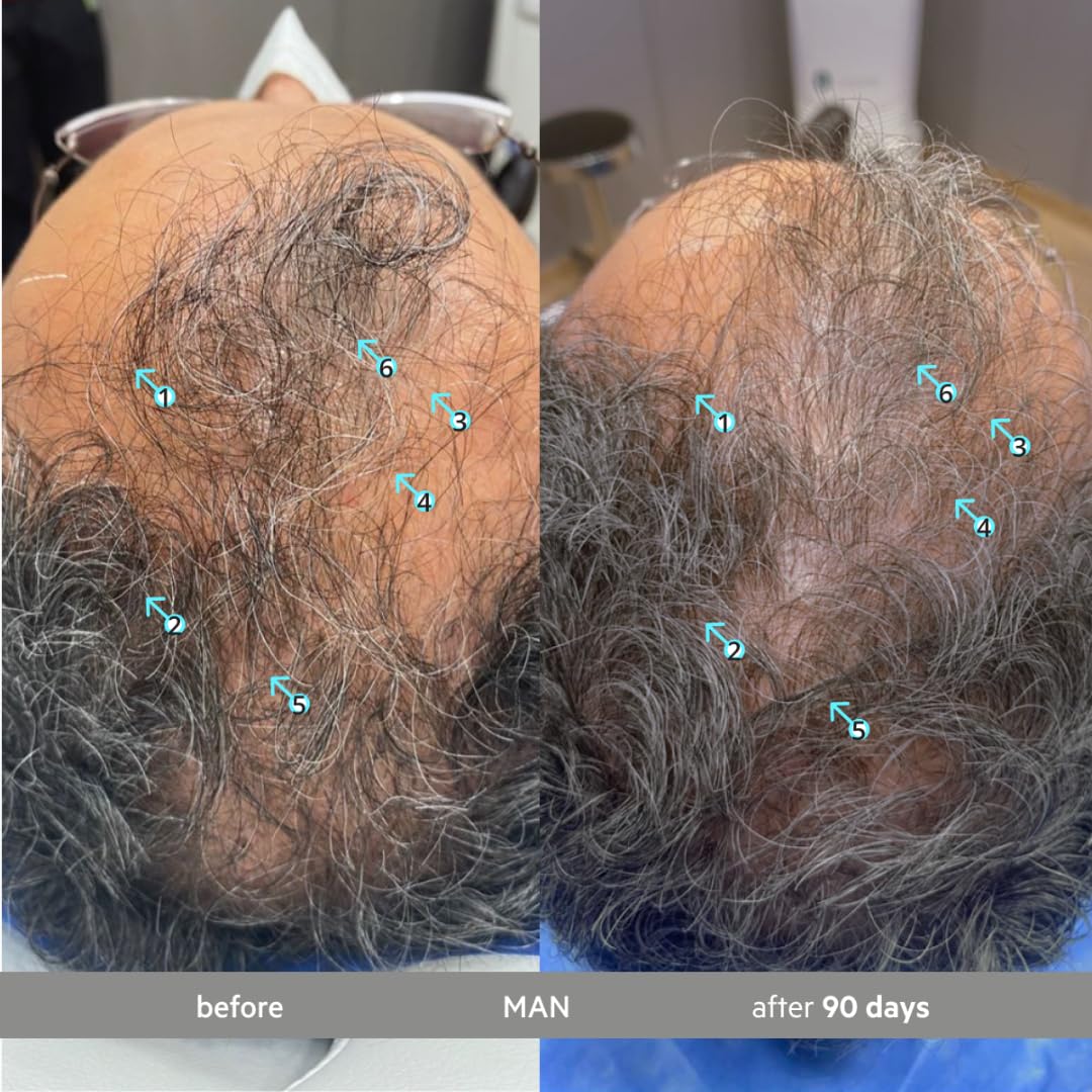 DS Laboratories textured serum on scalp indicating lightweight absorption and non‑greasiness