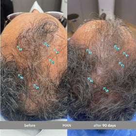 DS Laboratories textured serum on scalp indicating lightweight absorption and non‑greasiness