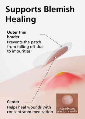 DWEasyDerm patch applied to cheek demonstrating discreet blemish coverage