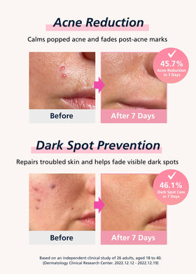 DWEasyDerm ingredient label showing niacinamide hyaluronic acid EGF benefits