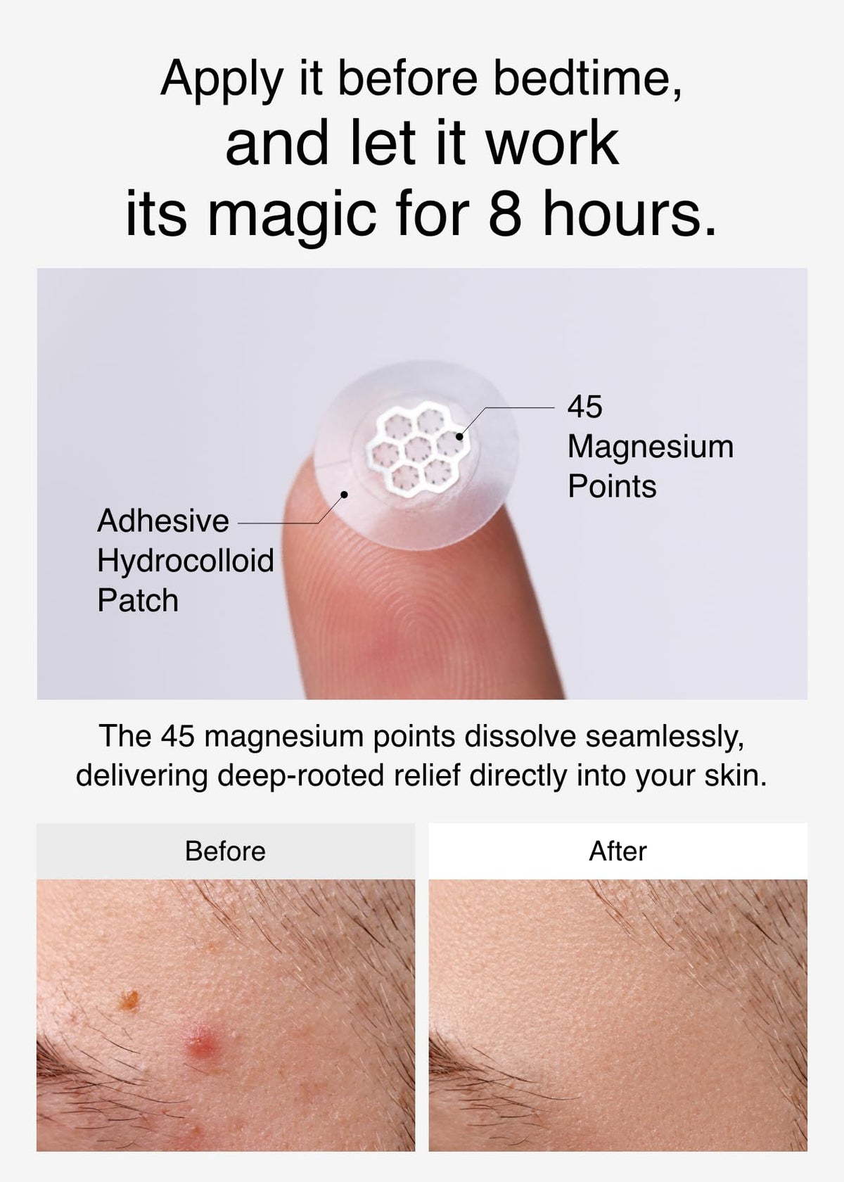DWEasyDerm tweezers placing patch precisely for hygienic application benefit