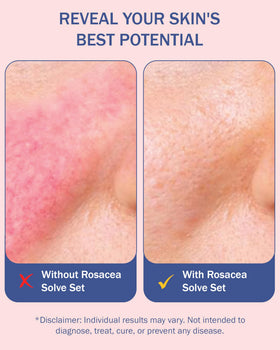 e70 ingredients aloe cucumber licorice highlighting soothing botanicals