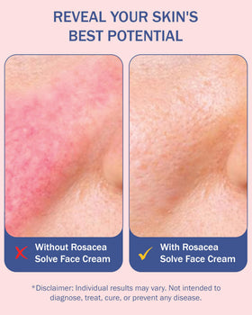 e70 ingredients aloe and hyaluronic studio layout showing soothing hydration benefit