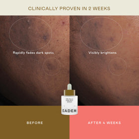 EADEM label close-up listing vitamin C and niacinamide, transparency of ingredients