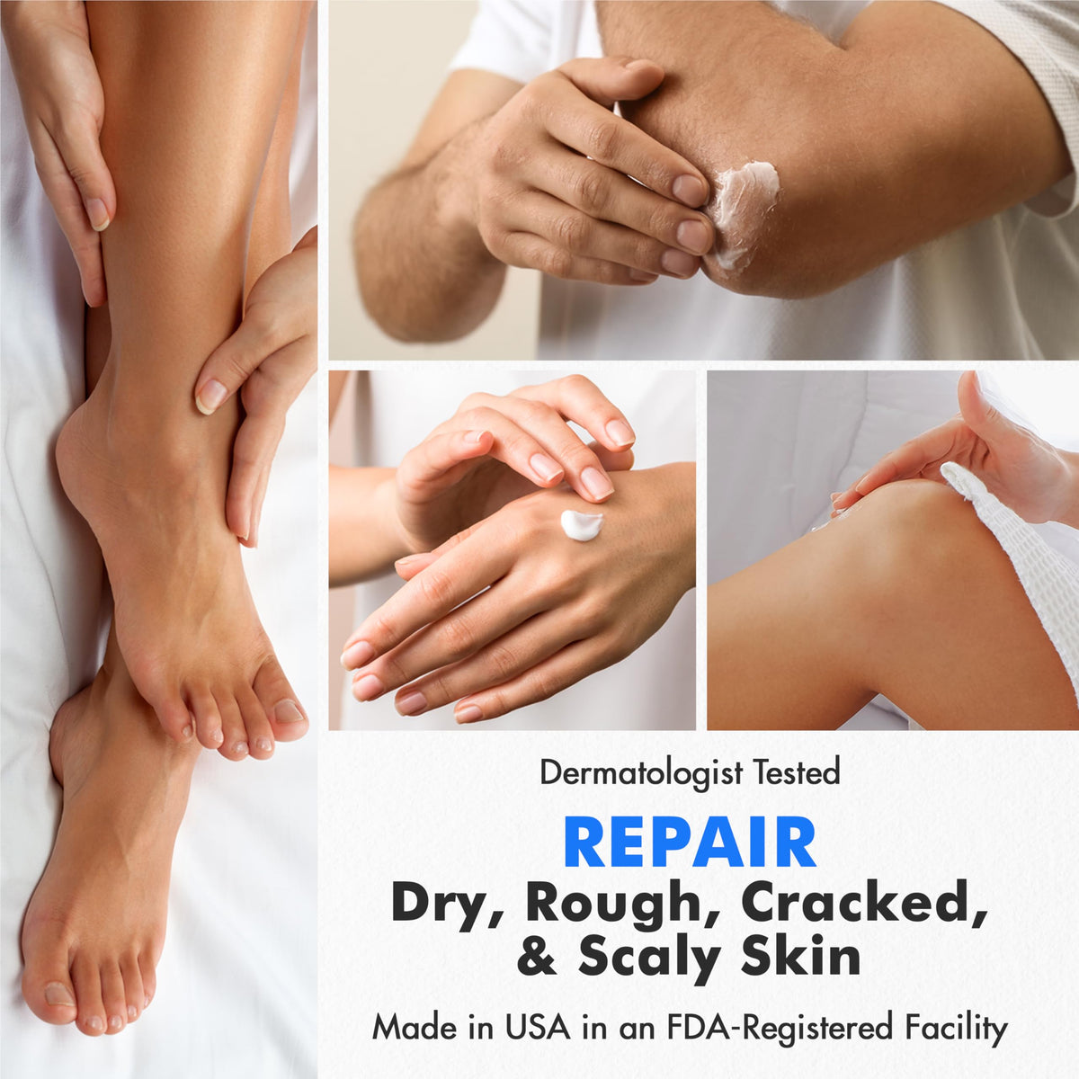 Ebanel before and after heels showing reduced callus and smoother skin