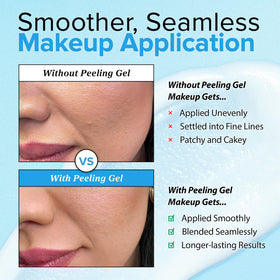Ebanel used on elbow showing body exfoliation and softer, smoother skin