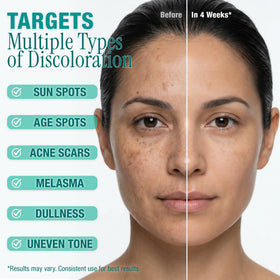 Ebanel label ingredients panel highlighting actives for even tone