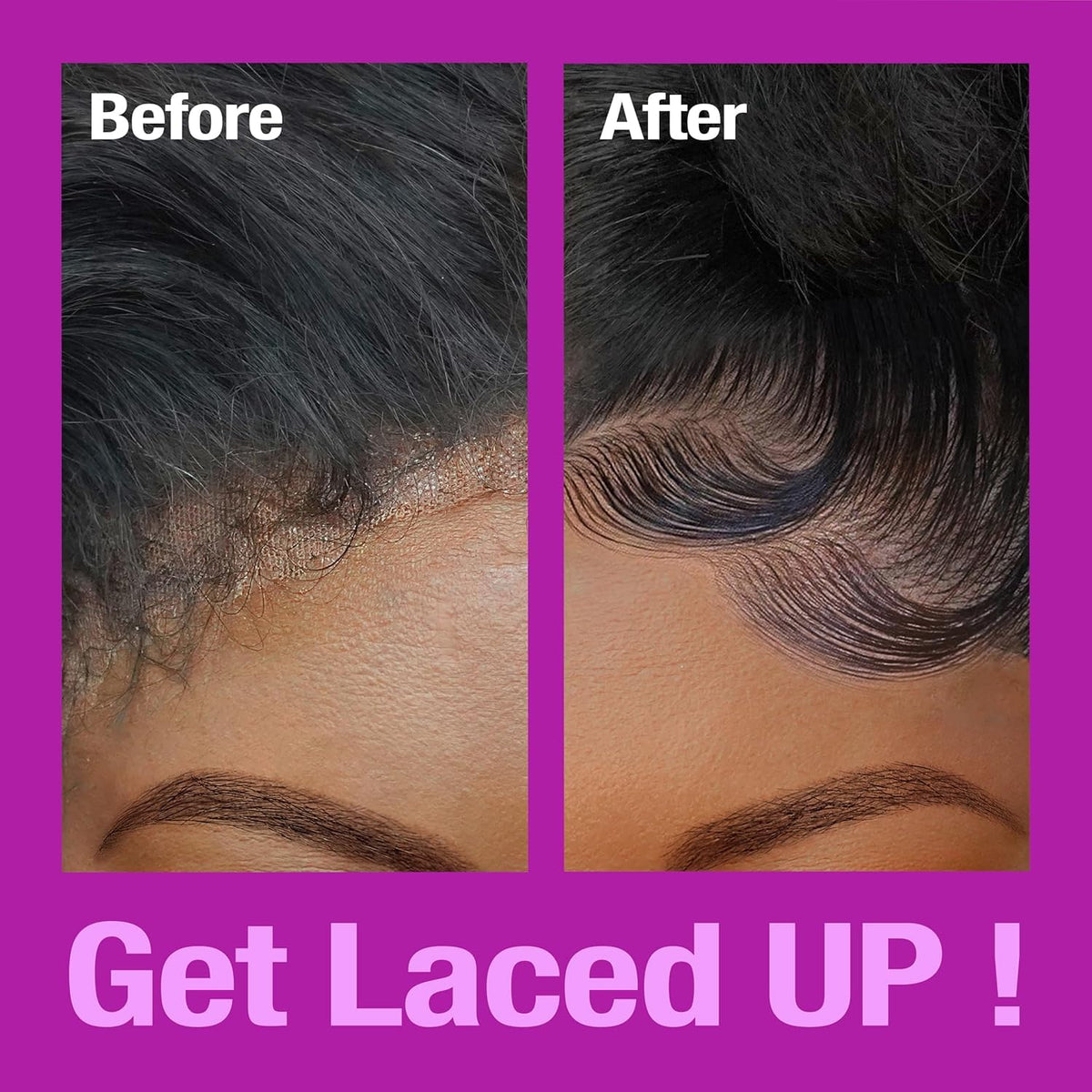 EBIN NEW YORK before-and-after hairline showing undetectable lace and natural blend