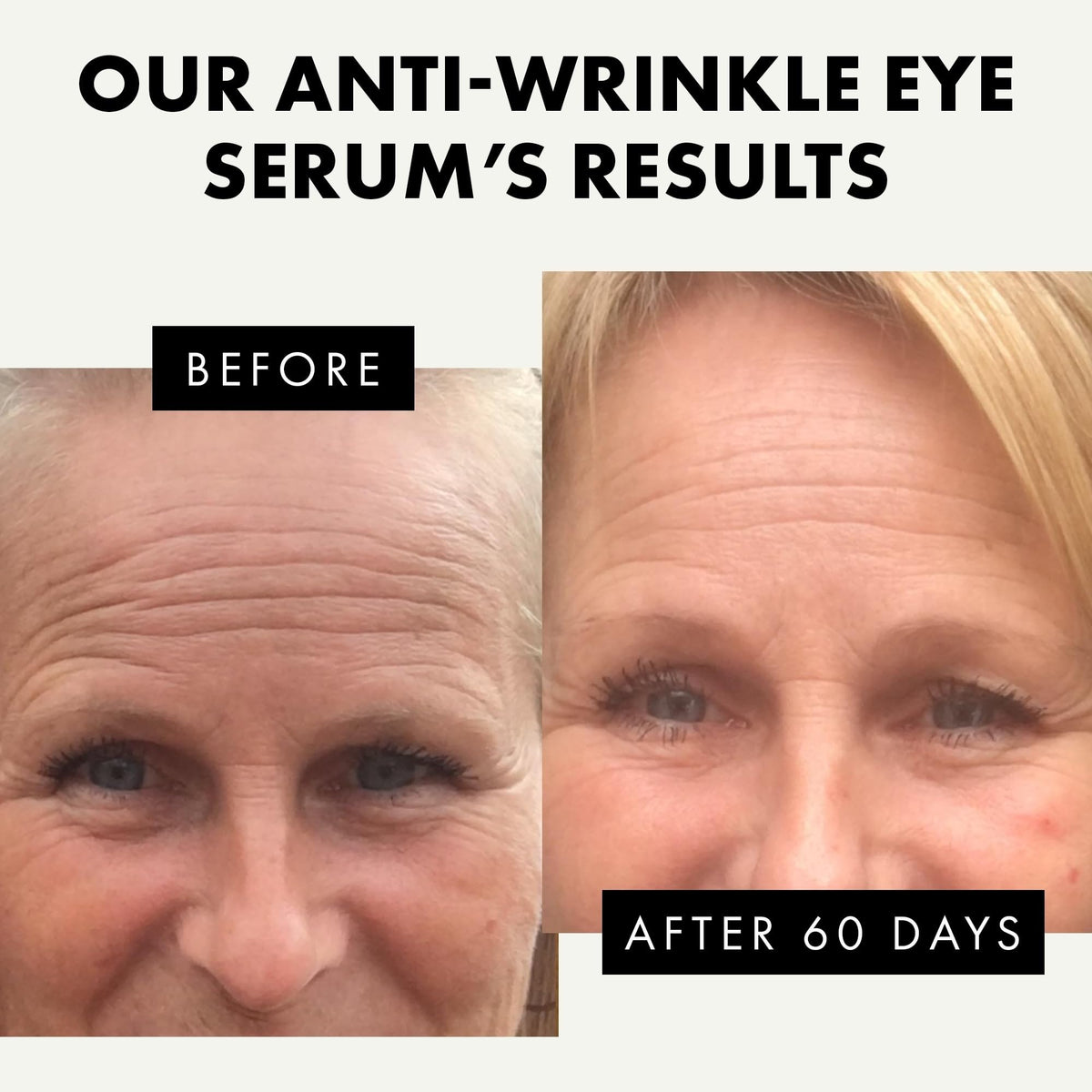 Eclat Skincare applied under-eye in routine demonstrating brighter-looking benefit