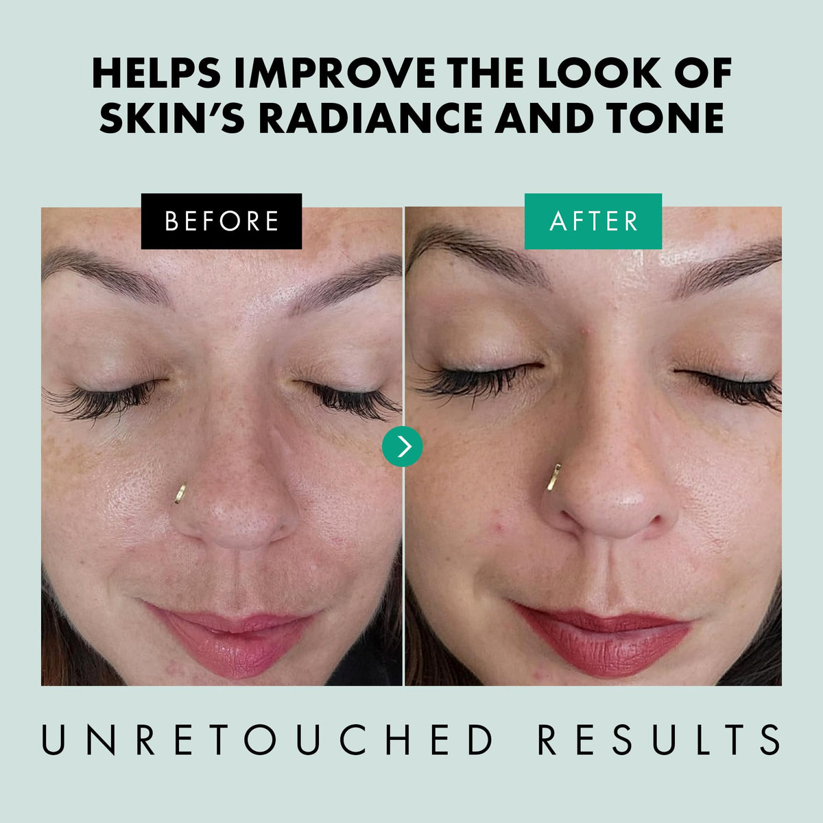 Eclat Skincare ingredient label close-up showing niacinamide and zinc PCA transparency benefit